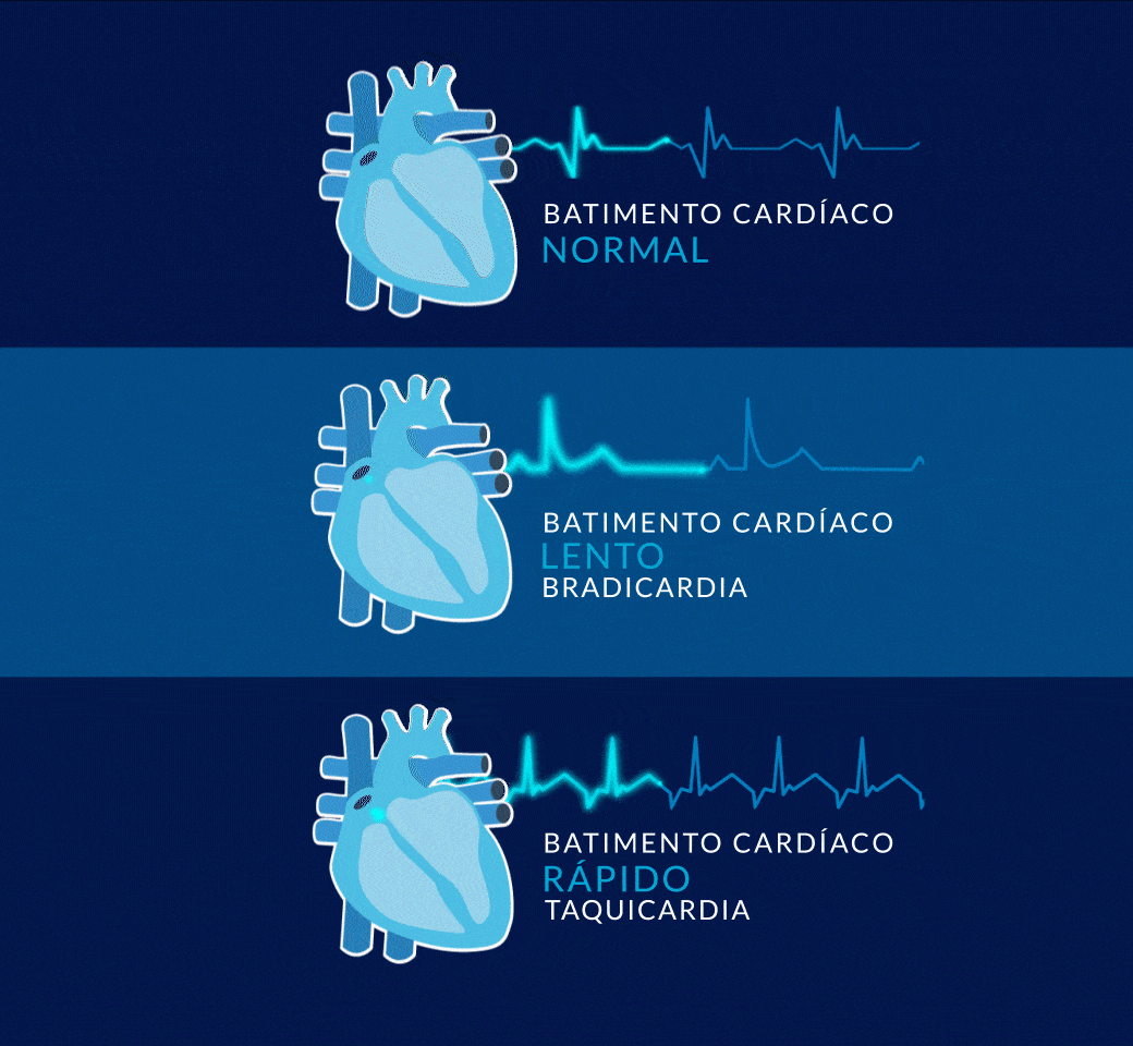 batimento cardíaco normal