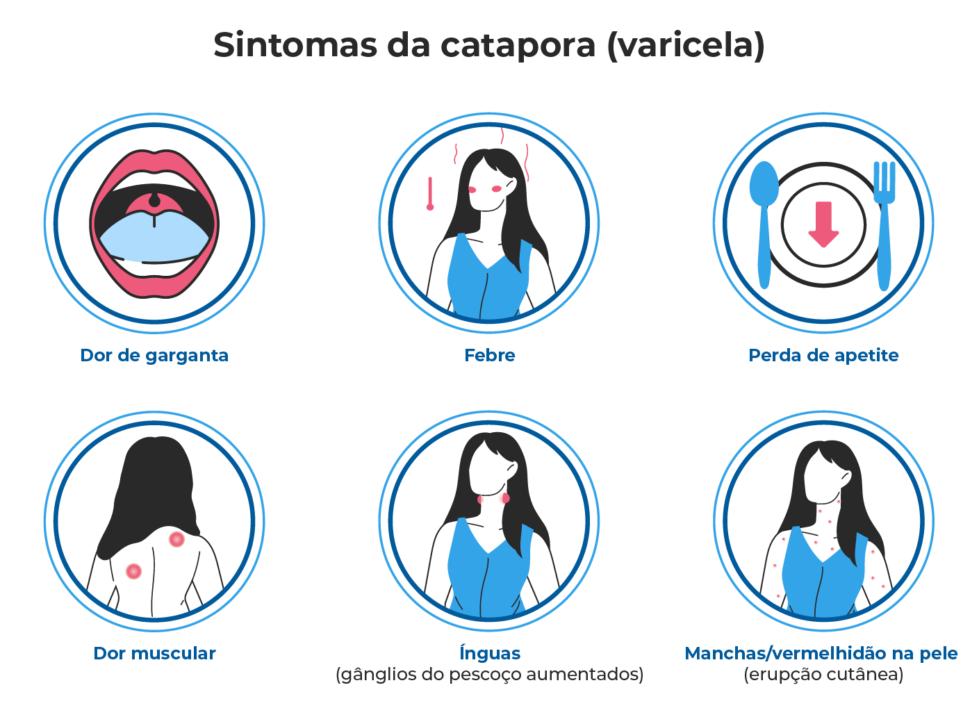 Entenda a diferença entre Catapora e Herpes Zóster