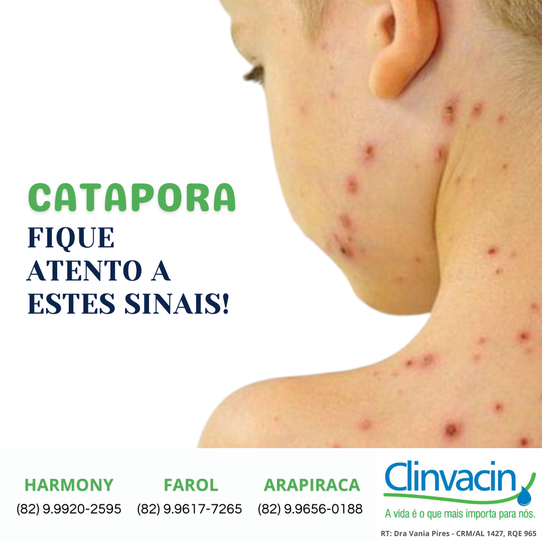 Como aumentar a imunidade contra a catapora
