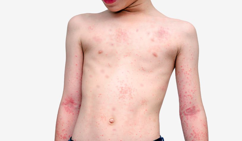 Como Consultar seu Cartão de Vacinação no ConecteSUS