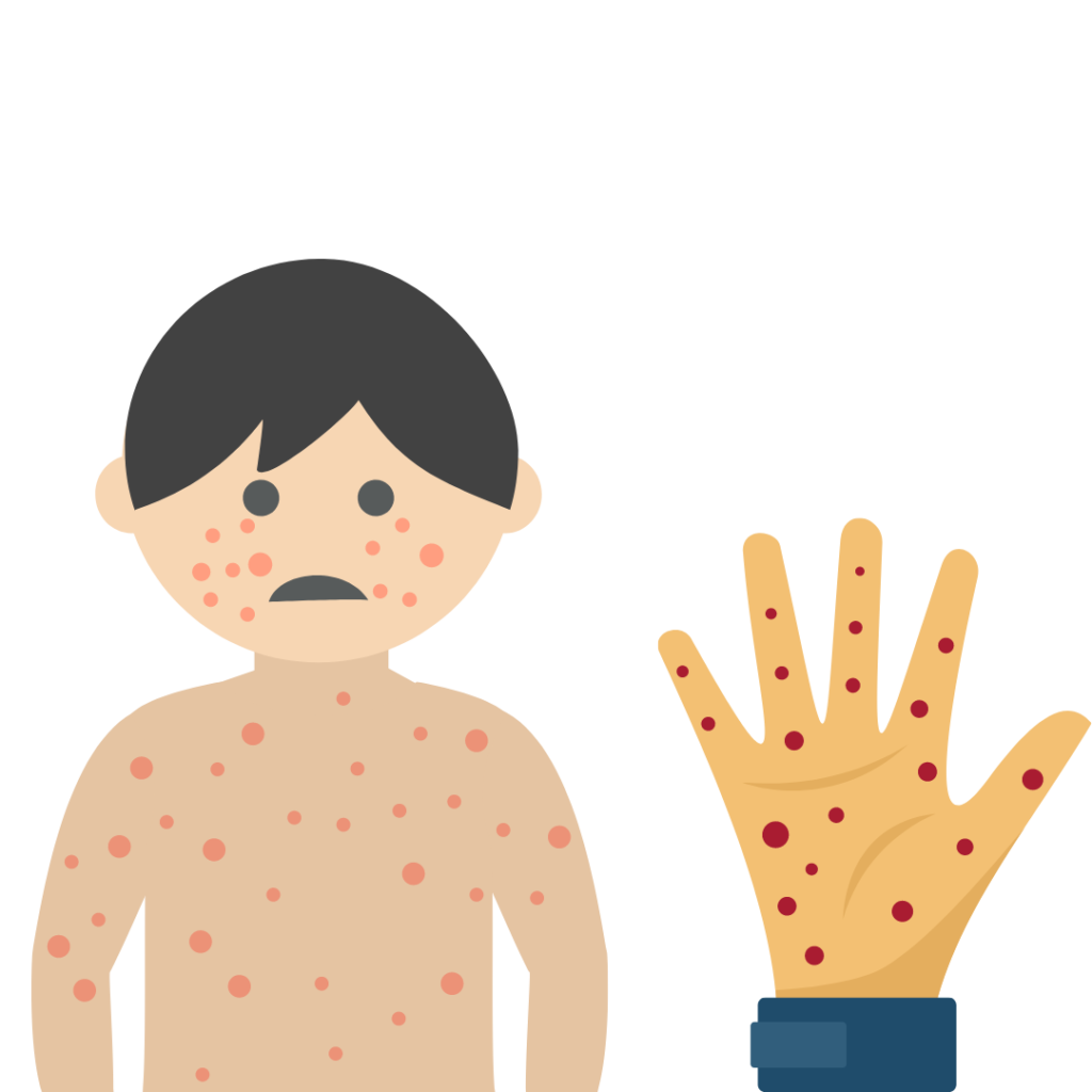 Rubéola em Adultos: Quem Precisa se Vacinar?