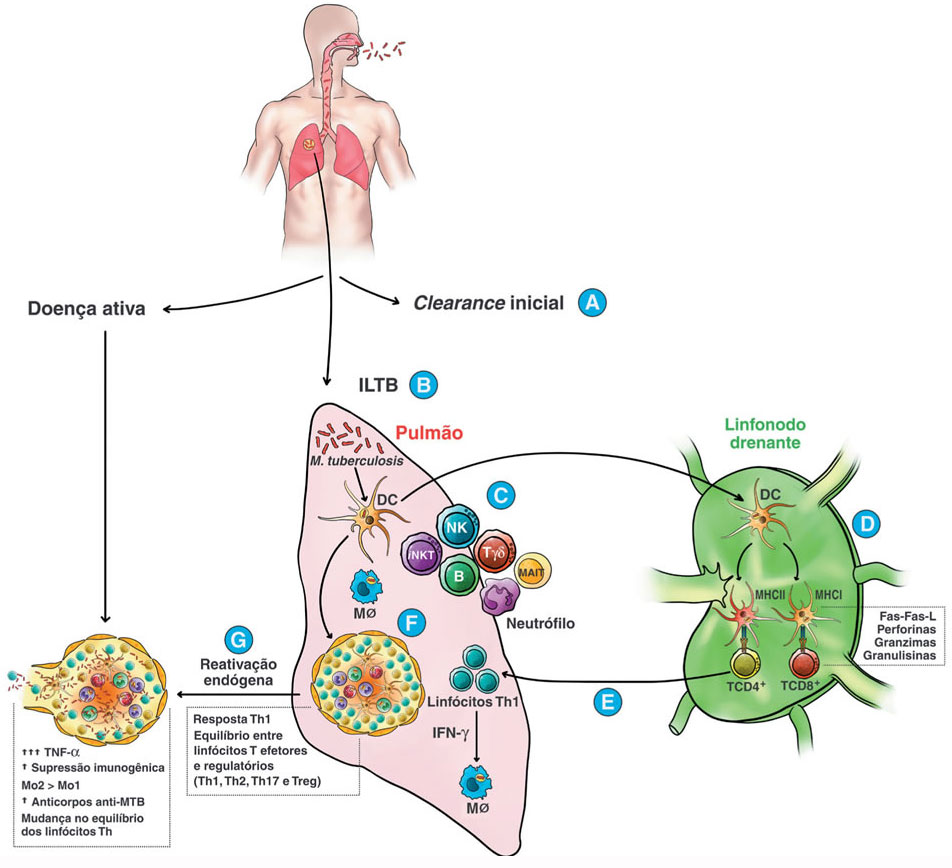 5 Dicas de Alimentação para Fortalecer a Imunidade contra Tuberculose
