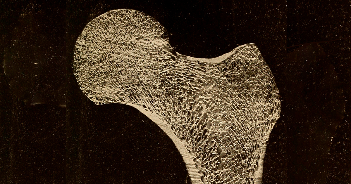 Estratégias de Prevenção de Quedas para Idosos: Um Guia Prático