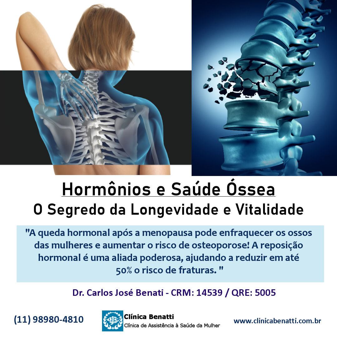 Entendendo a Terapia de Reposição Hormonal e Seus Benefícios Ósseos