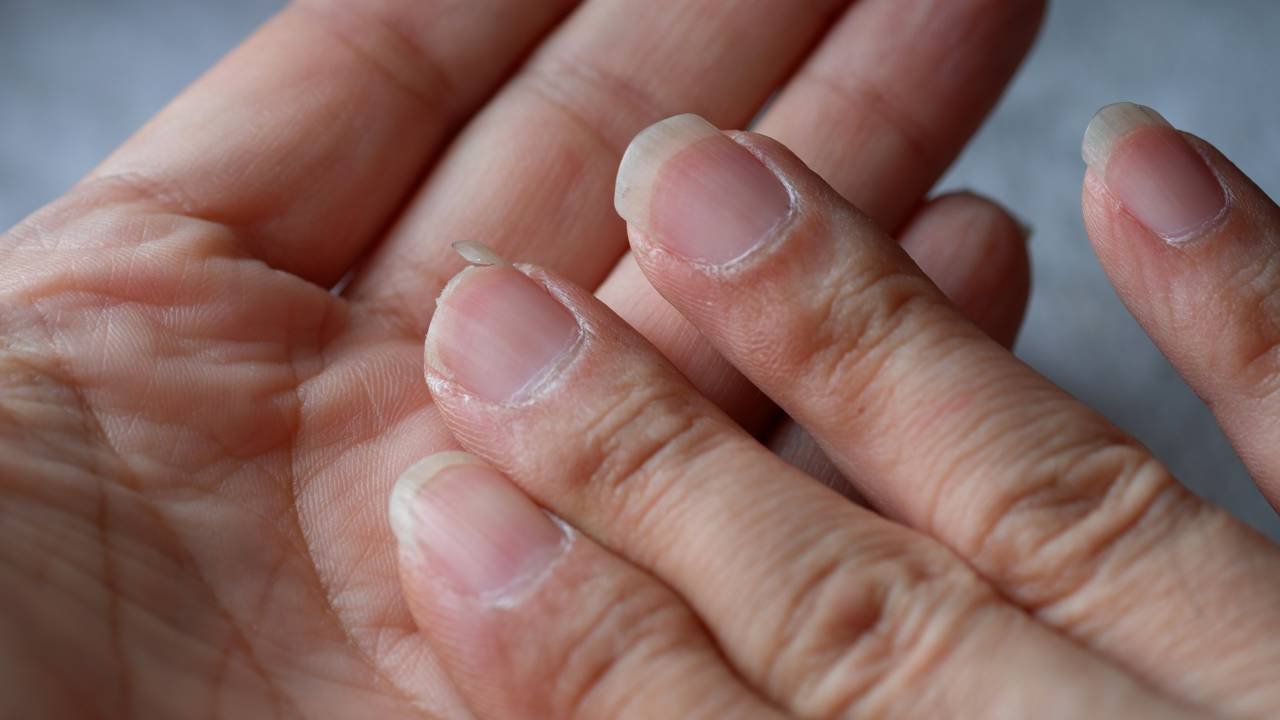 Como clarear as unhas dos pés com limão e azeite