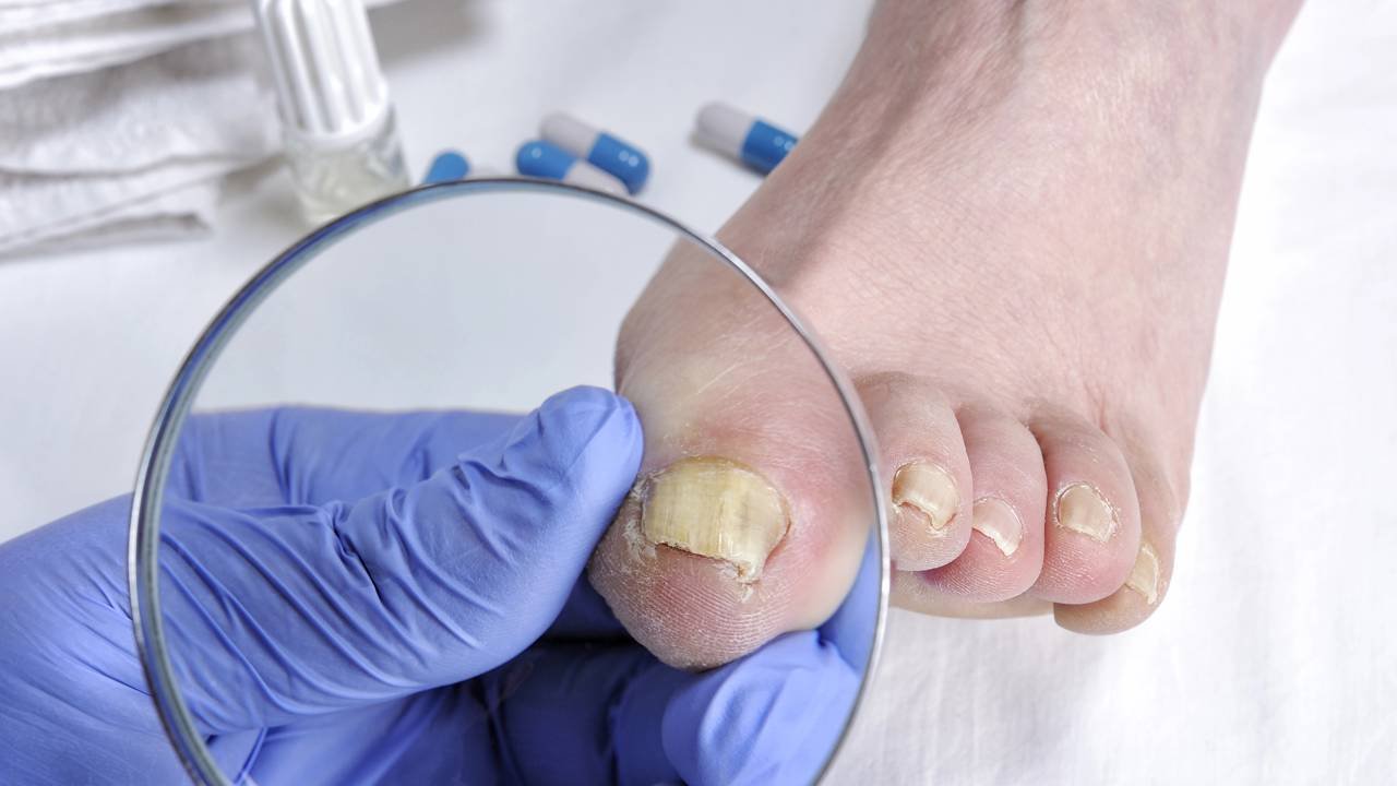 5 Dicas para Prevenir Unhas Amareladas