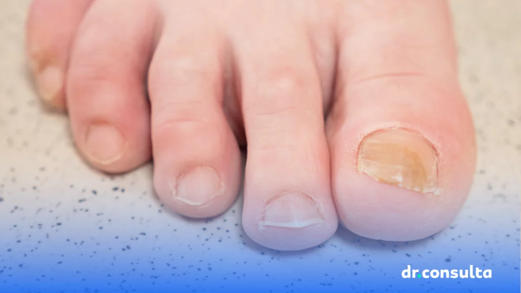 Guia Completo de Cuidados com os Pés