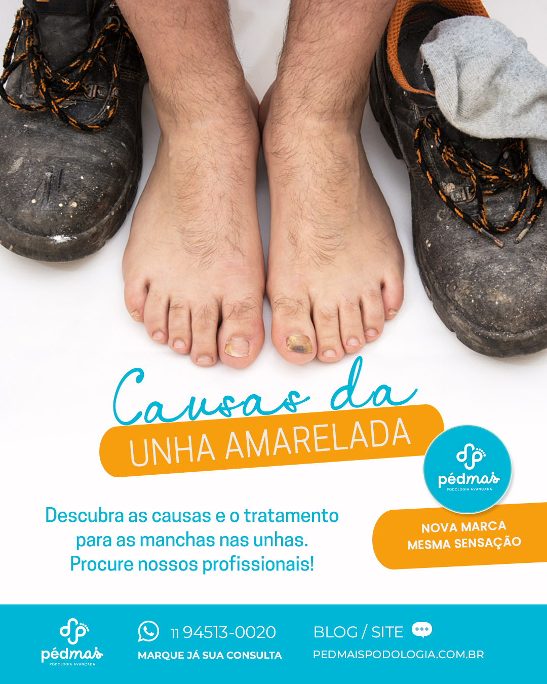 Os Melhores Esmaltes para Evitar Manchas