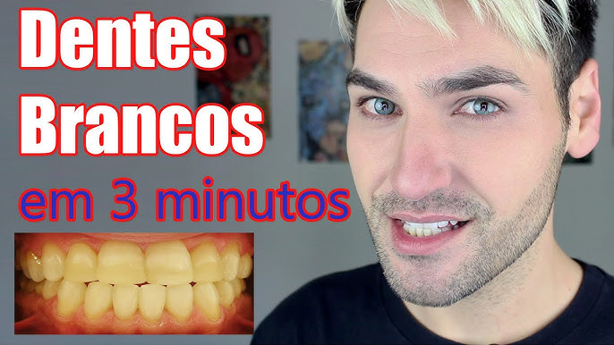 Como clarear os dentes com açafrão e óleo de coco