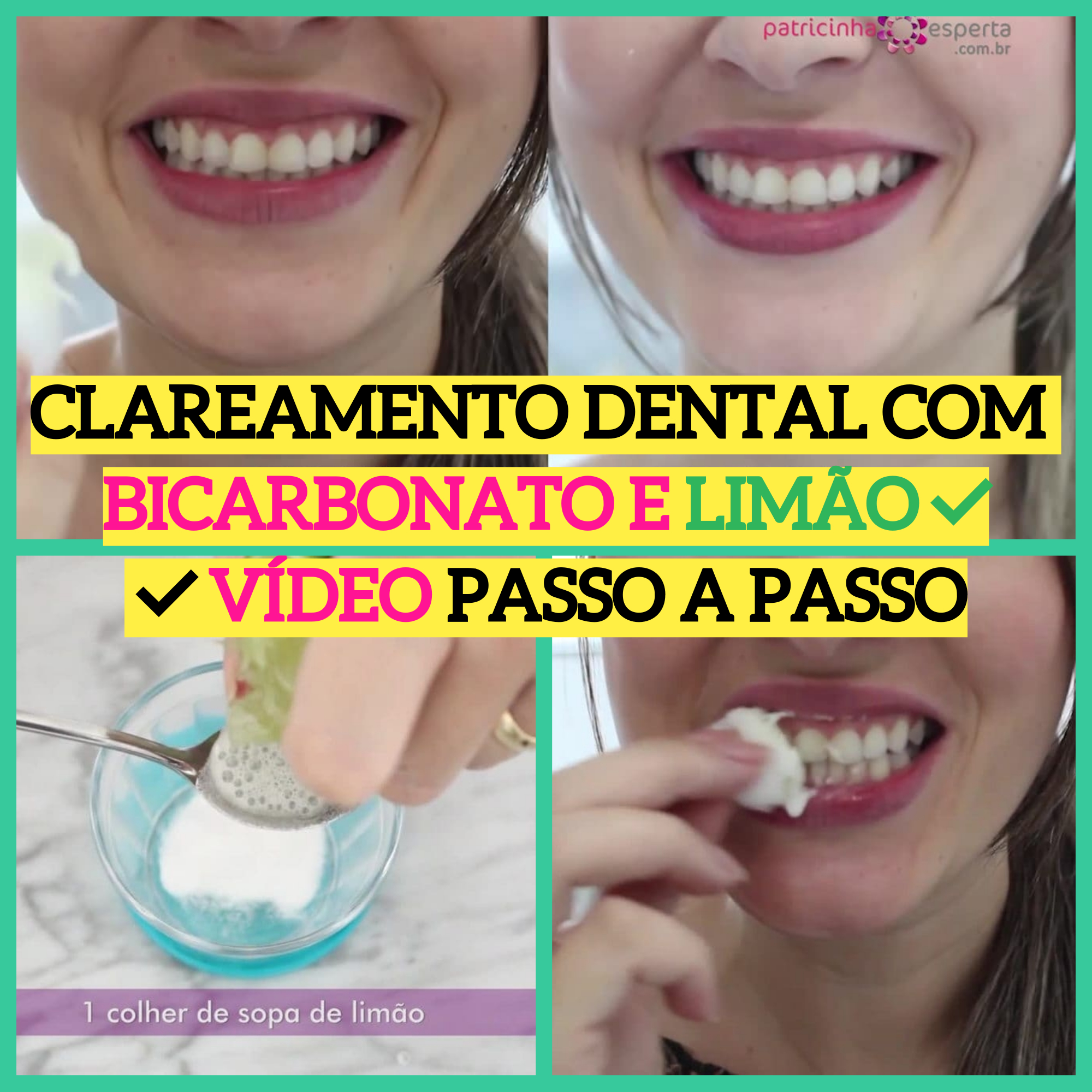 Clareamento Dental Caseiro vs. Profissional: Qual a Melhor Opção?