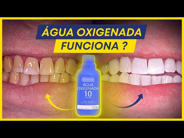 Como clarear os dentes com bicarbonato e água oxigenada