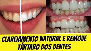 Como clarear os dentes com bicarbonato e óleo de coco