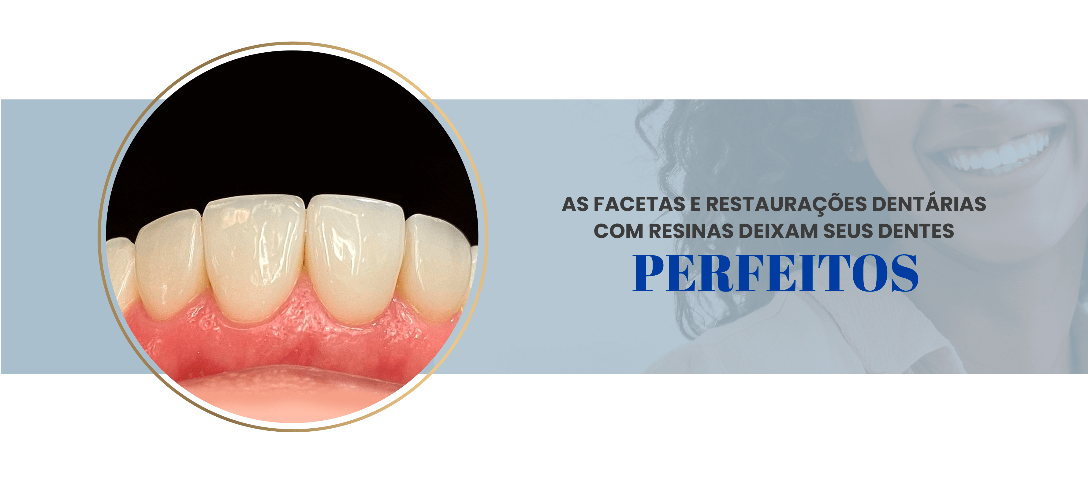 Como clarear os dentes com facetas