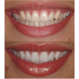 Guia Completo de Higiene Bucal