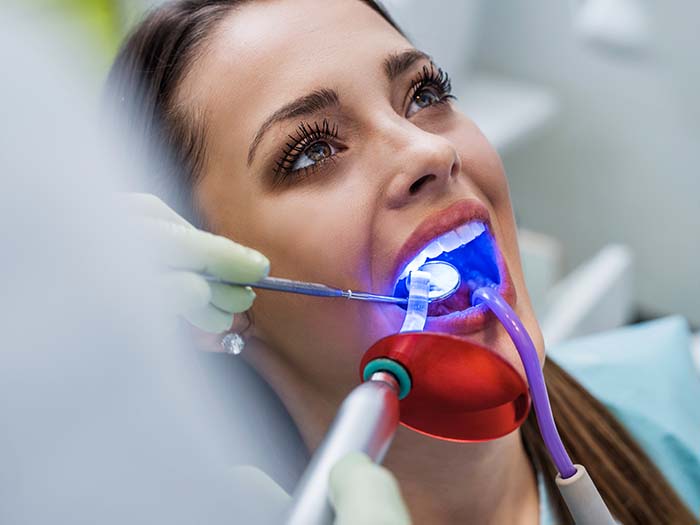 Cuidados Essenciais Após o Clareamento Dental a Laser