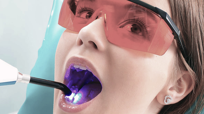 Como clarear os dentes com laser