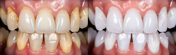 Desmistificando Mitos Populares sobre Higiene Dental