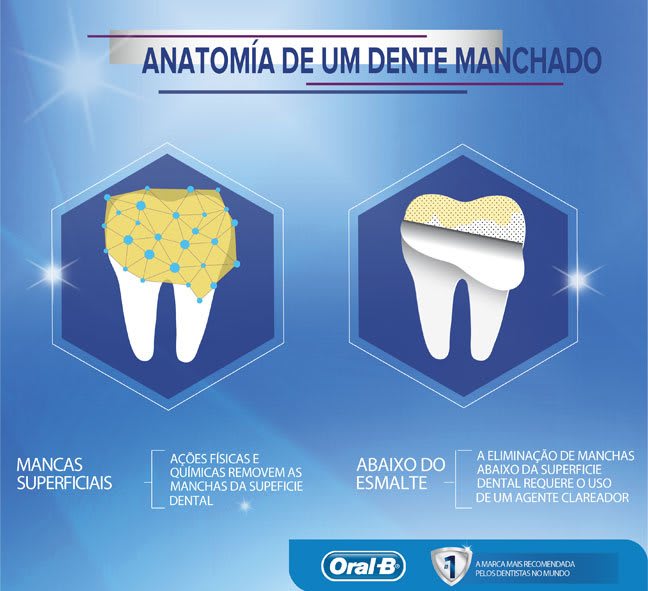 Como clarear os dentes manchados