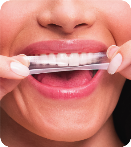 Os Riscos do Bicarbonato de Sódio para o Esmalte Dental