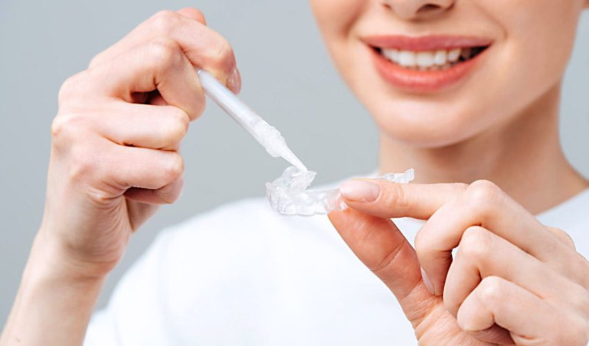 Os Riscos do Bicarbonato de Sódio para o Esmalte Dental