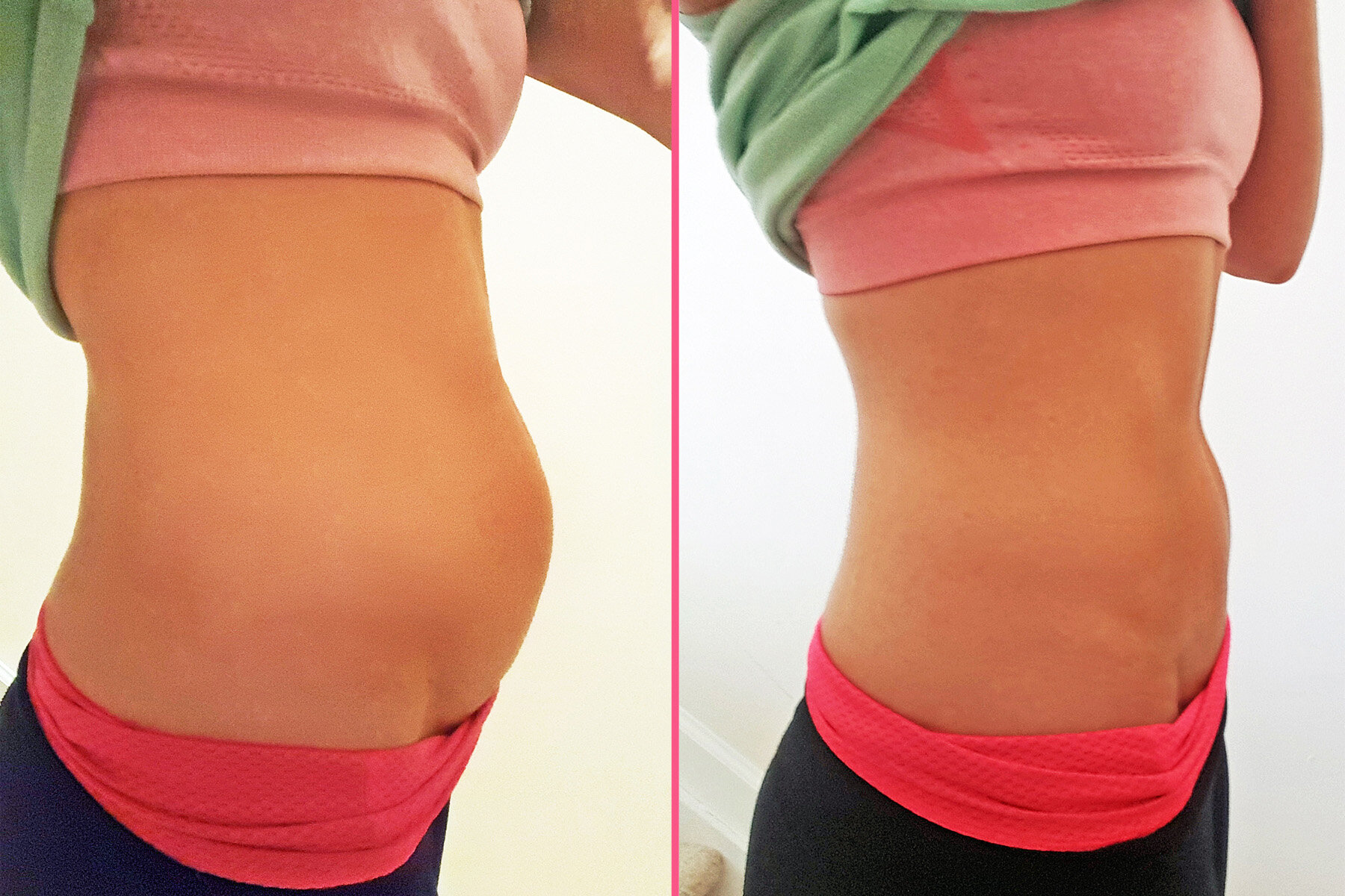 5 Chás Naturais para Aliviar Gases