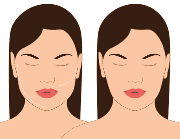 Guia Completo de Procedimentos Estéticos para Afinar o Rosto