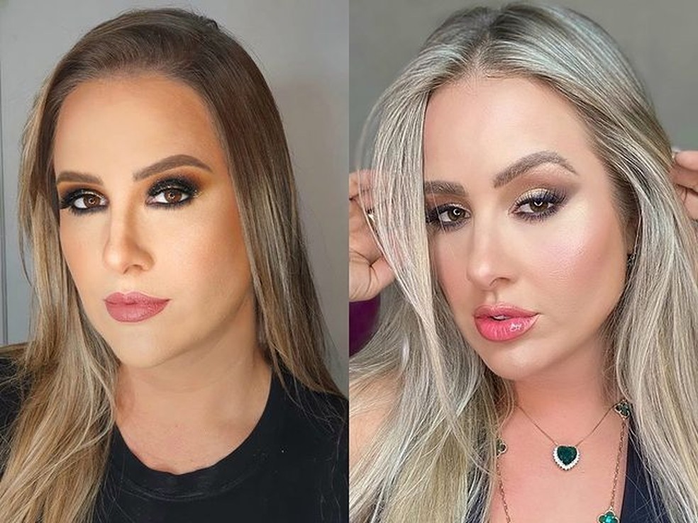 5 Alimentos que Causam Inchaço Facial e Como Evitá-los