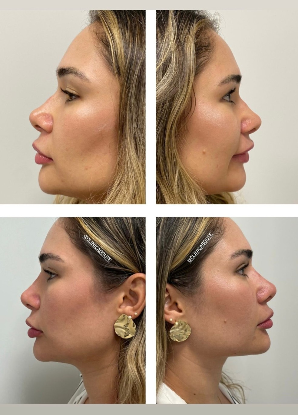 Exercícios Aeróbicos que Aceleram a Perda de Gordura Corporal Total