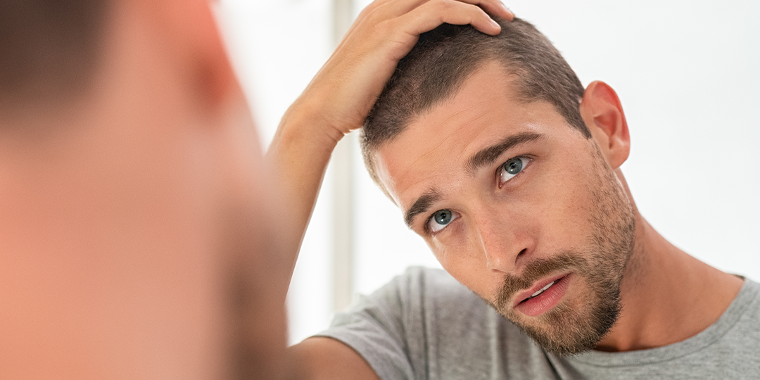 O que é DHT e como ele causa calvície?