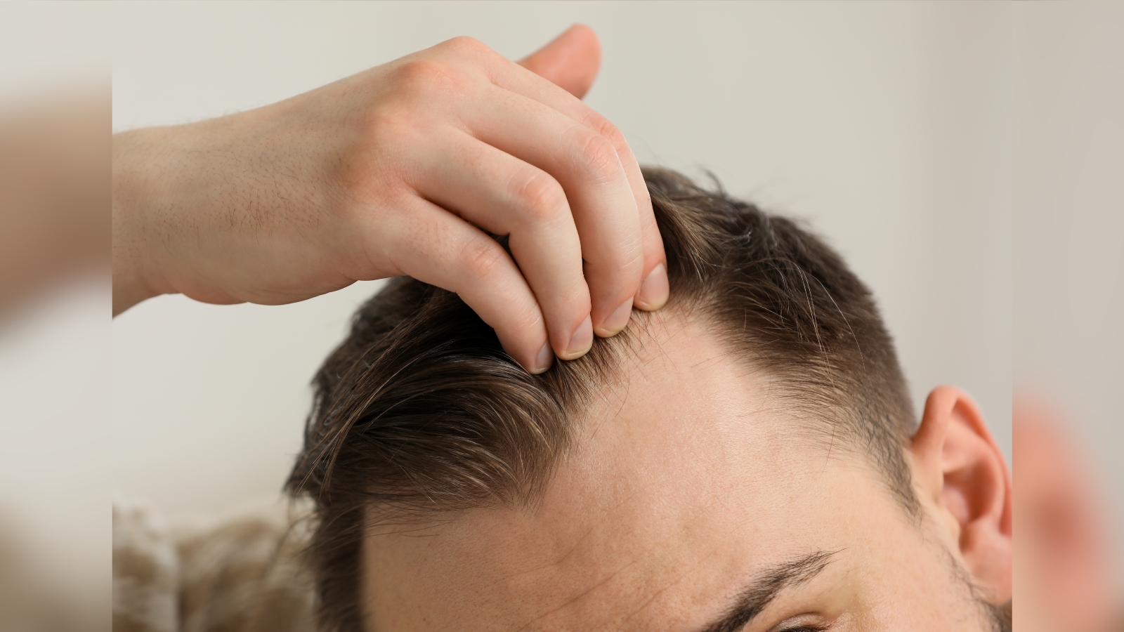 Como evitar a calvície