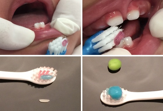 Guia completo de alimentação para bebês sem cáries