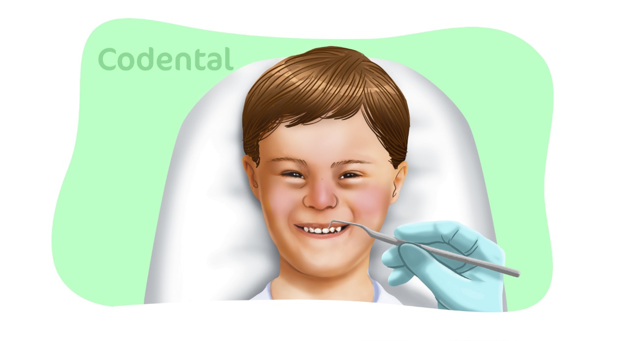 Como adaptar a escovação para crianças com síndrome de Down