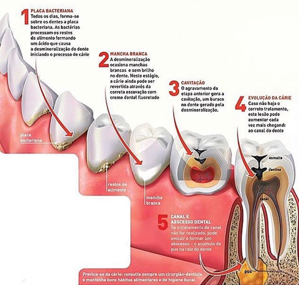 Como Escolher o Melhor Irrigador Oral para Você