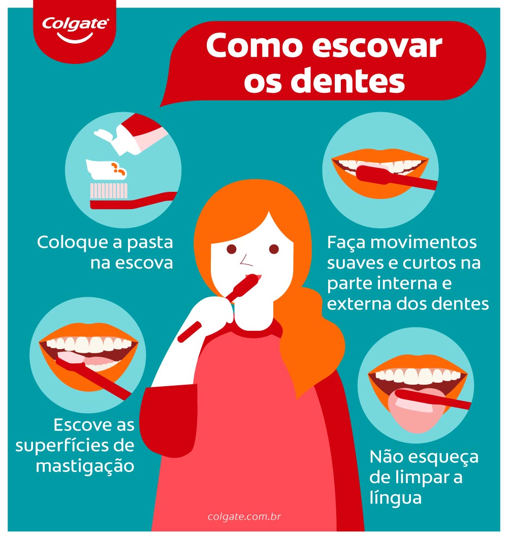 Como evitar a cárie em dentes com restauração