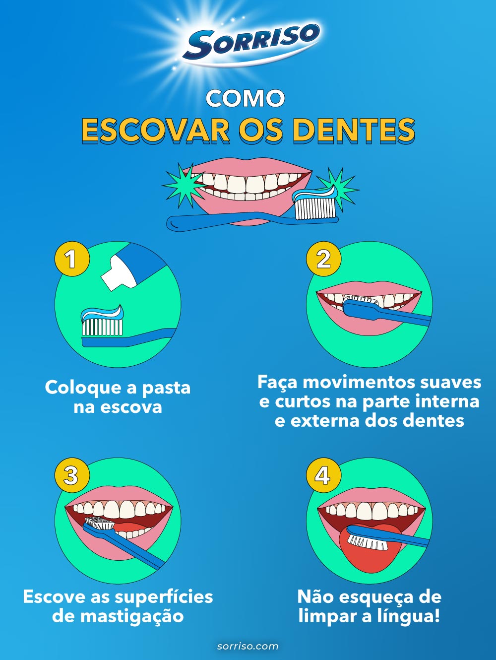 Como evitar a cárie em dentes com restauração