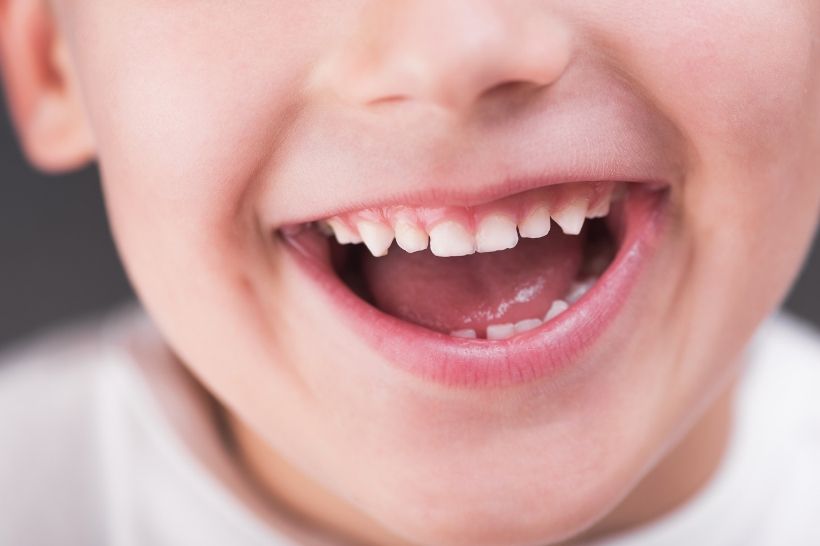 Alimentos que fortalecem os dentes do seu filho