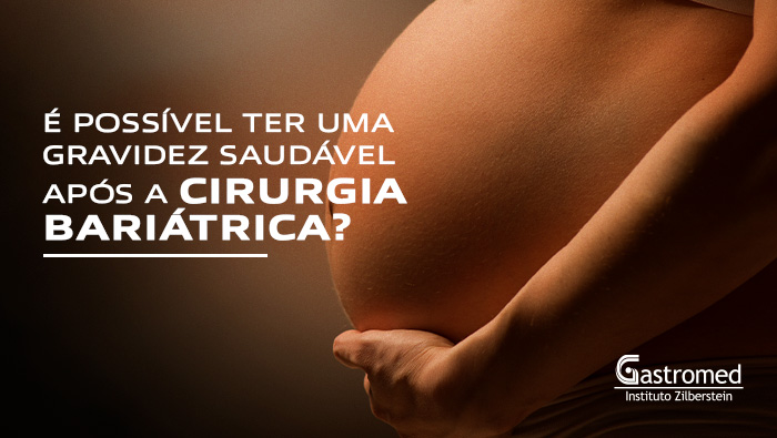 Como evitar a gravidez após cirurgia bariátrica