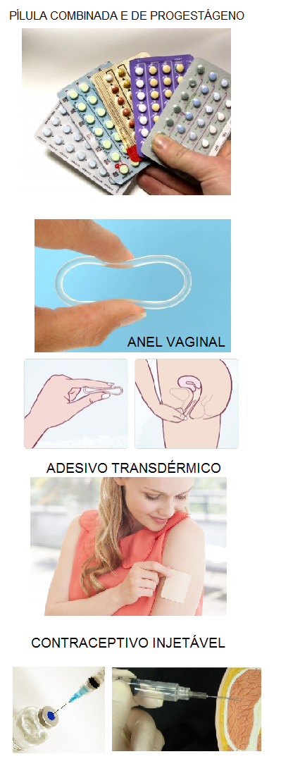 Como evitar a gravidez indesejada com anel vaginal