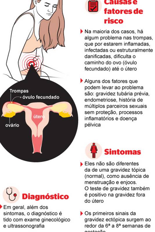 Como evitar a gravidez tubária