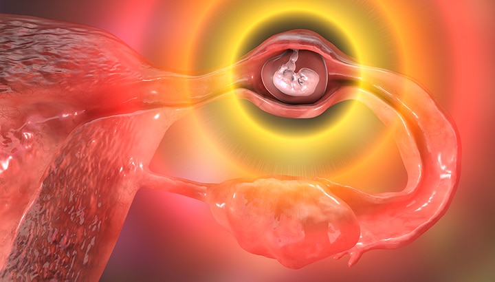 Métodos contraceptivos: qual o mais indicado para você?