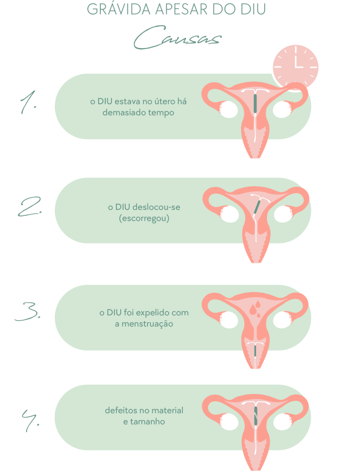 DIU de Cobre: Proteção e Segurança a Longo Prazo