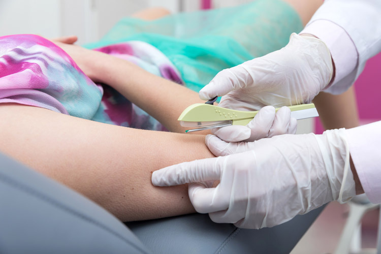 Proteção Completa: Preservativo e Métodos Hormonais