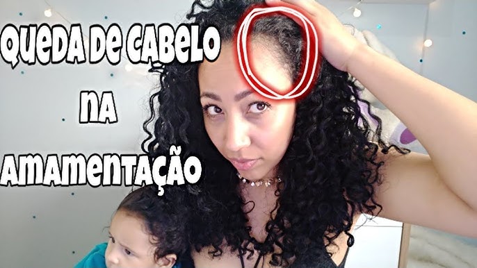 Como evitar a queda de cabelo por amamentação