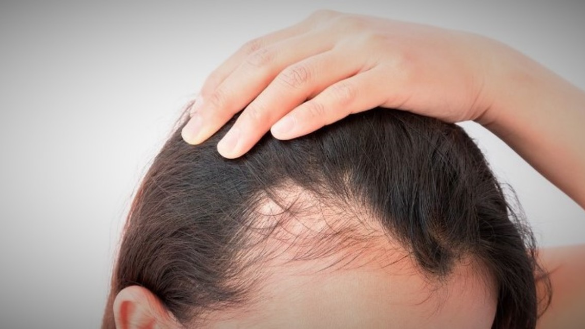 Mitos e verdades sobre a biotina e o crescimento capilar