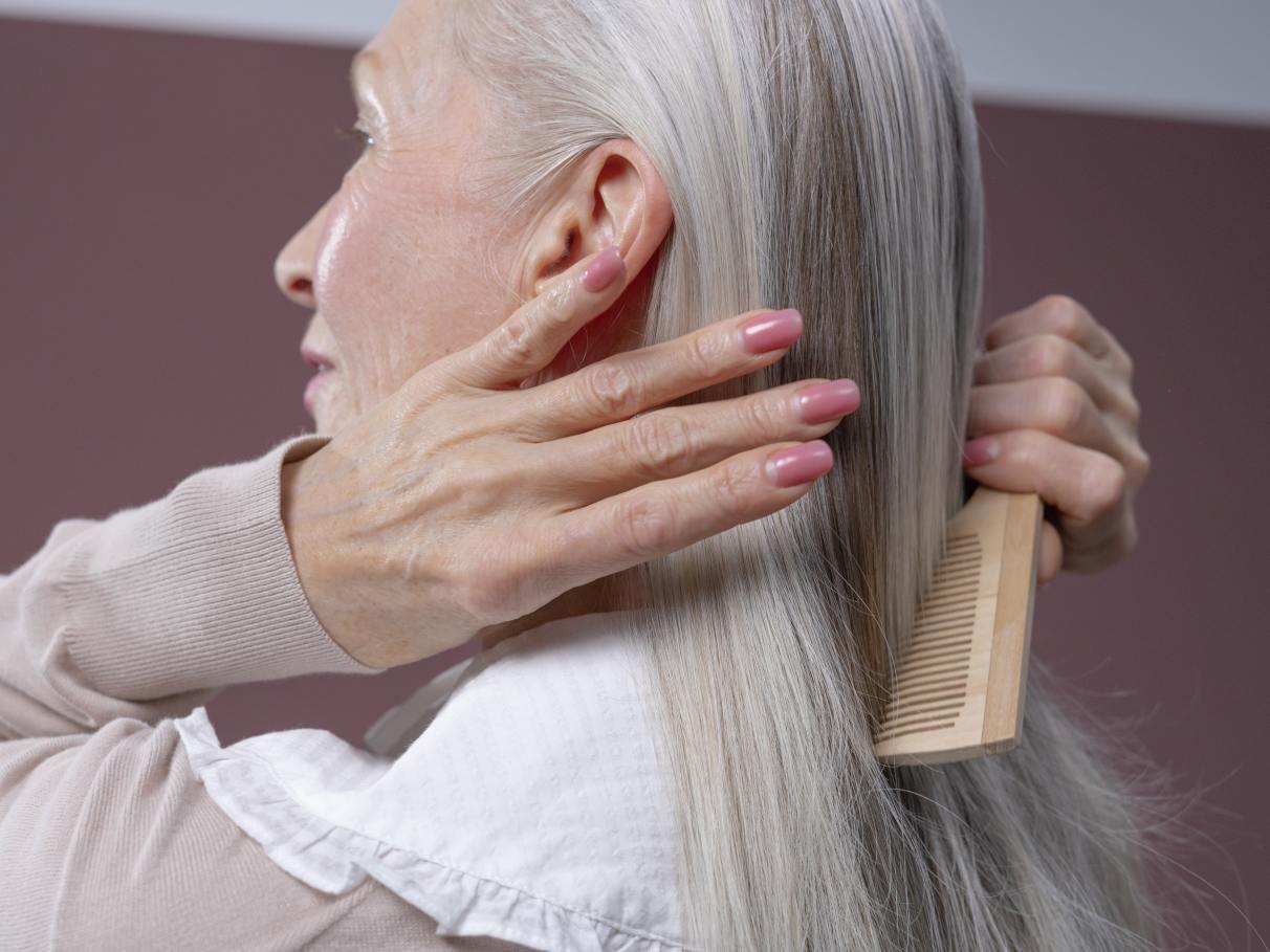 Como o Minoxidil Age na Queda de Cabelo Feminina