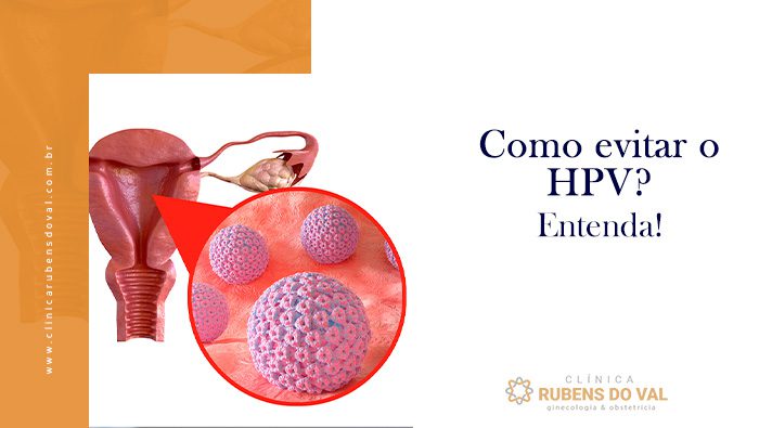 Como evitar a transmissão de HPV genital