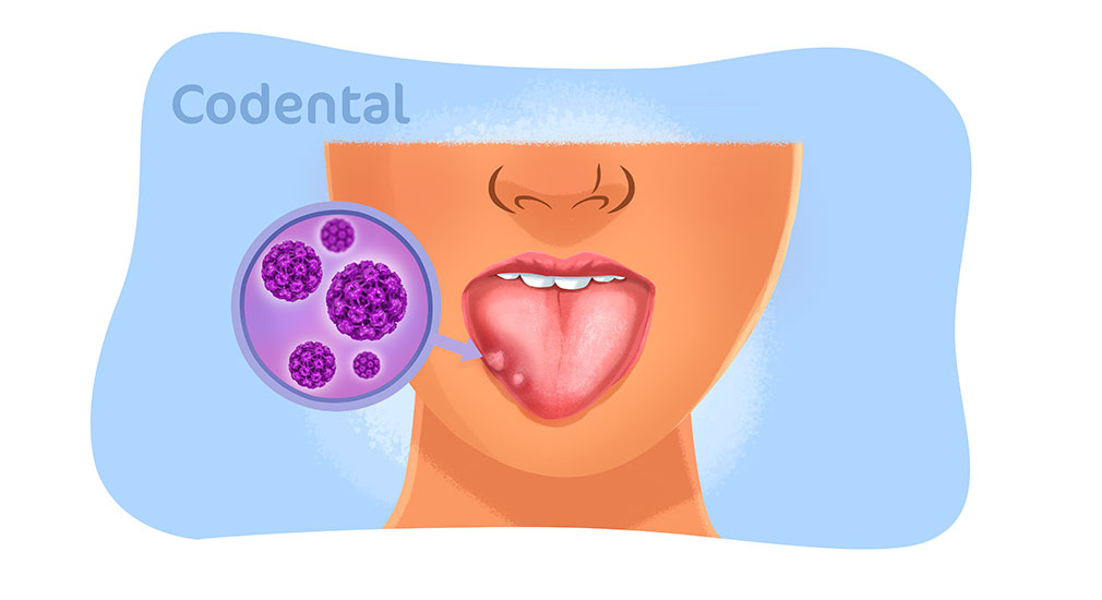 A Importância da Vacinação contra o HPV para Jovens e Adultos
