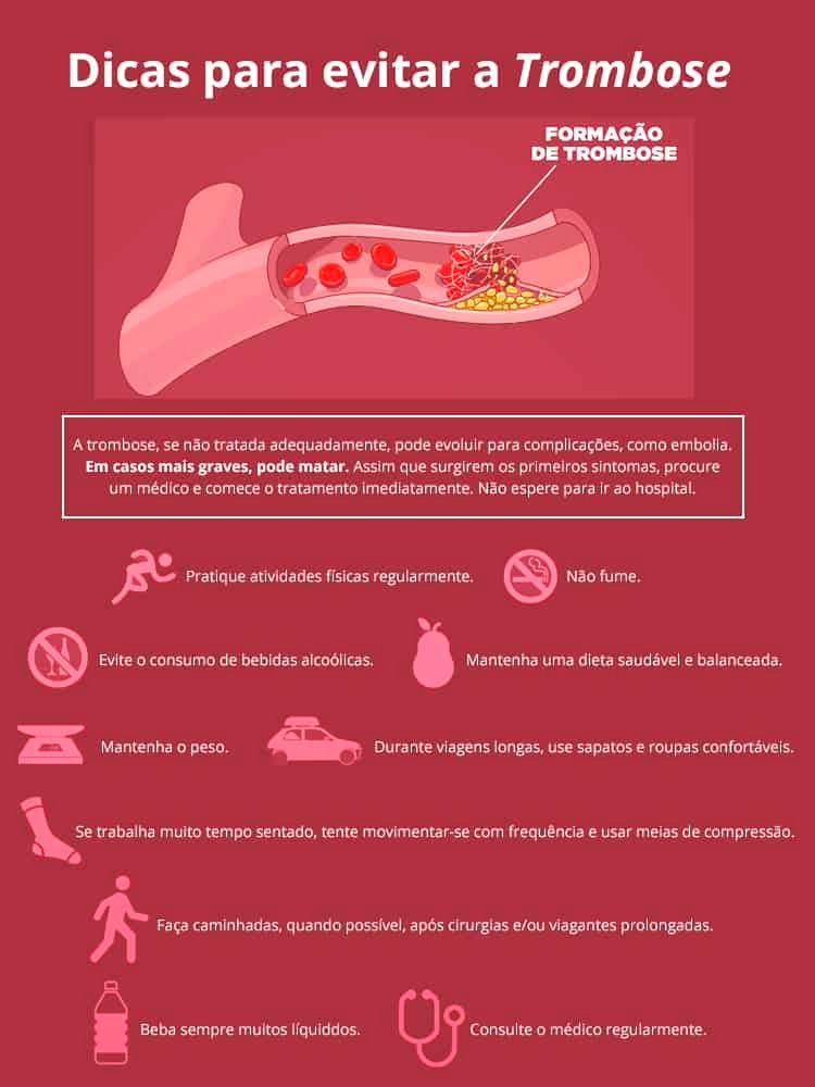Como evitar a trombose