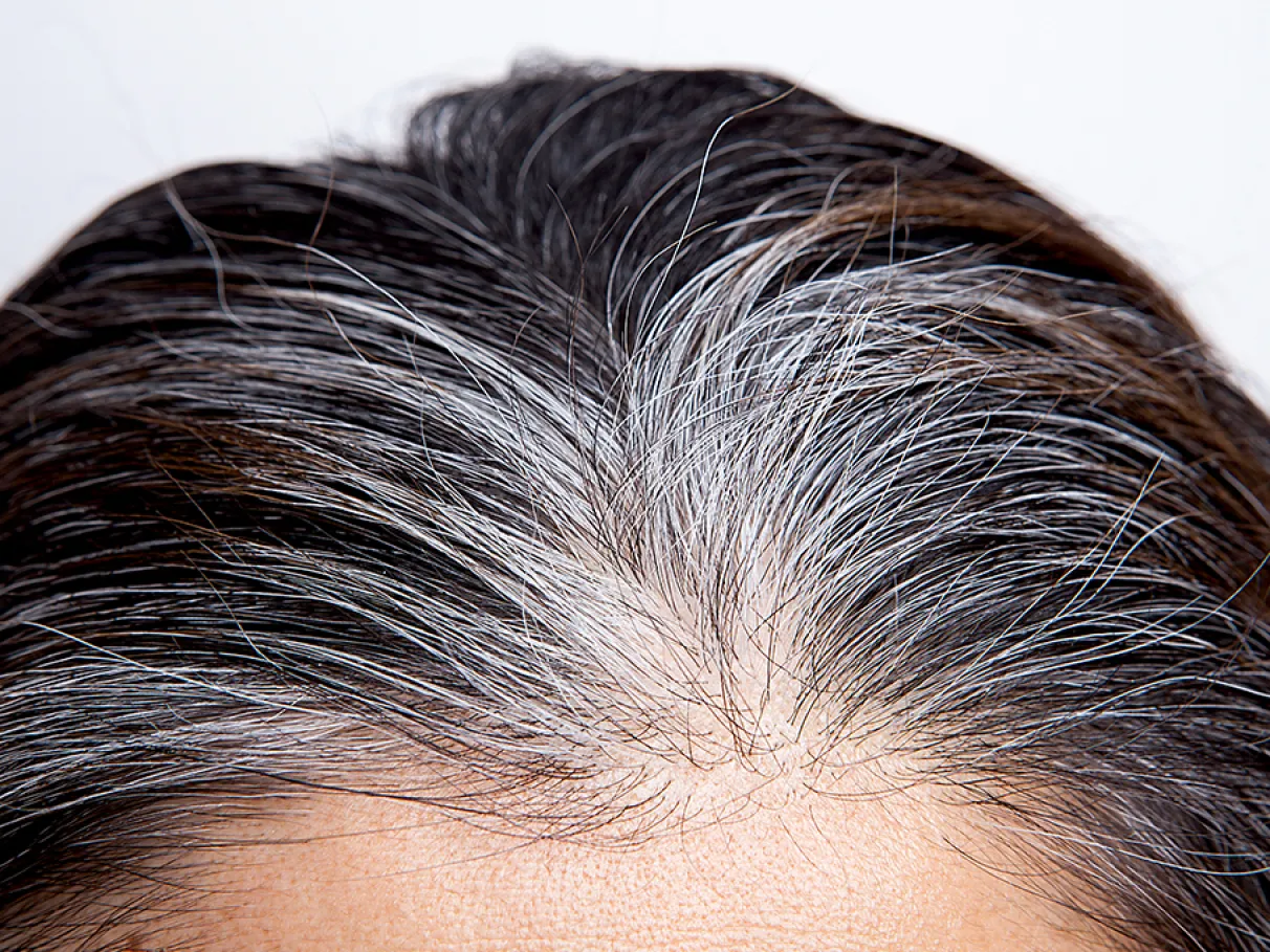 Mitos e Verdades Sobre o Surgimento de Cabelos Brancos