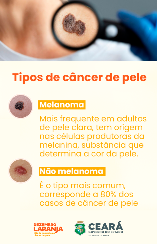 Guia Completo: Como ler o rótulo do protetor solar